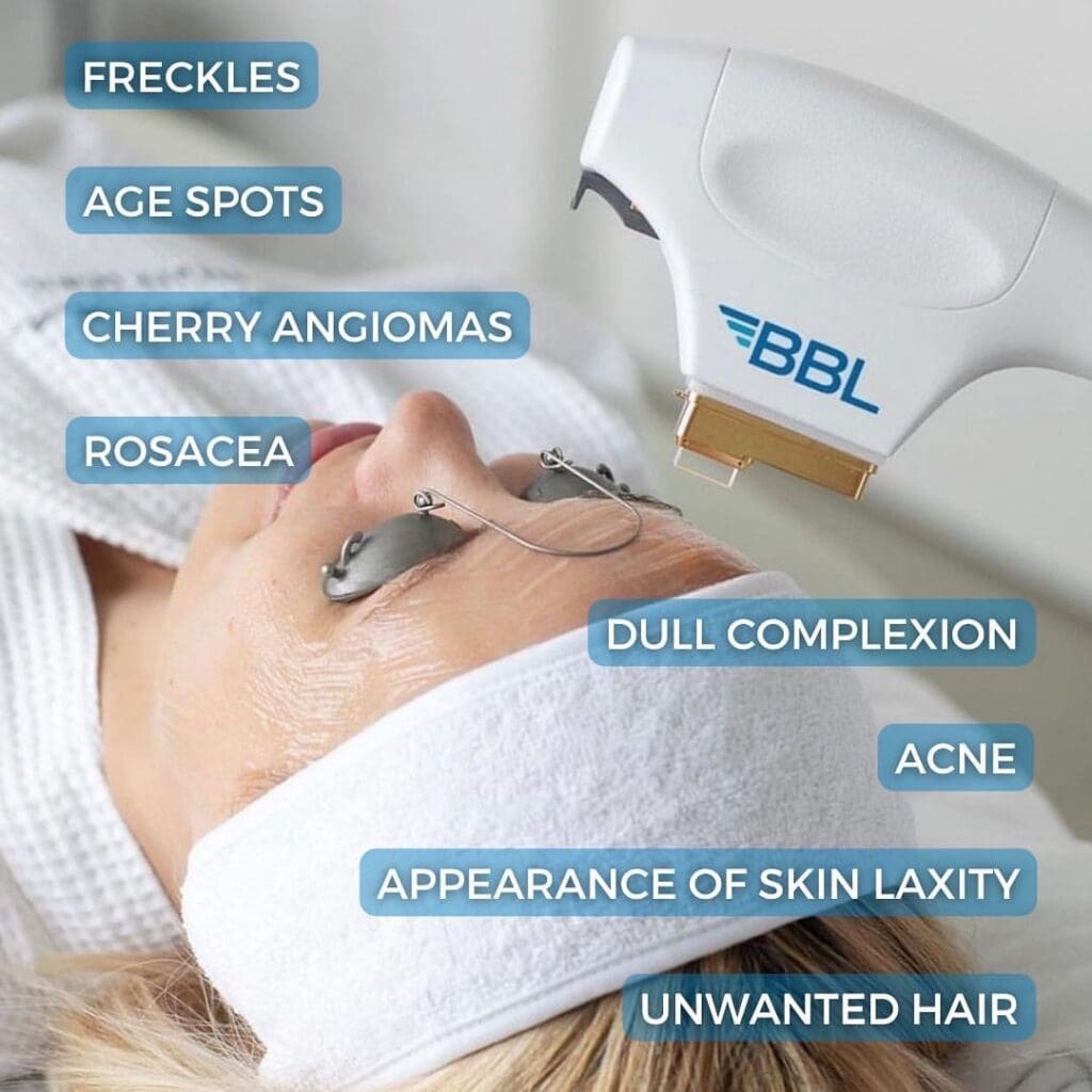 picture of a woman getting bbl. the picture shows all the indications for bbl treatment.