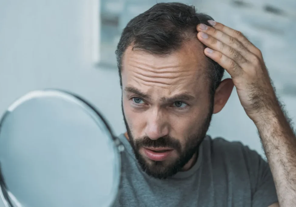 Upset middle-aged man with a beard touching his hair while looking in a mirror